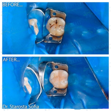 Врач стоматолог-терапевт Староста С.Б.