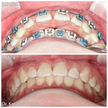 Dentistry «Lumi-Dent» in Kyiv Dentistry «Lumi-Dent» in Kyiv