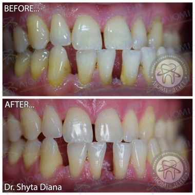 Dentistry «Lumi-Dent» in Kyiv