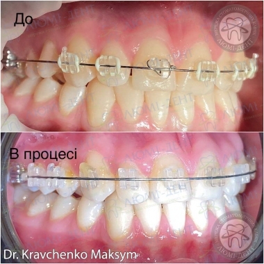 Dentistry «Lumi-Dent» in Kyiv