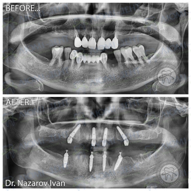 Dentistry «Lumi-Dent» in Kyiv