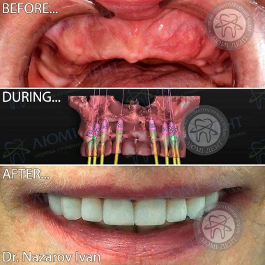 Dentistry «Lumi-Dent» in Kyiv