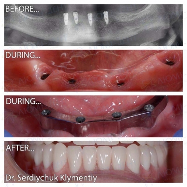 примеры работ хирург Сердийчук Климентий