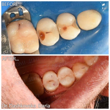 Dentistry «Lumi-Dent» in Kyiv