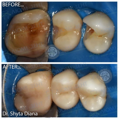 Dentistry «Lumi-Dent» in Kyiv