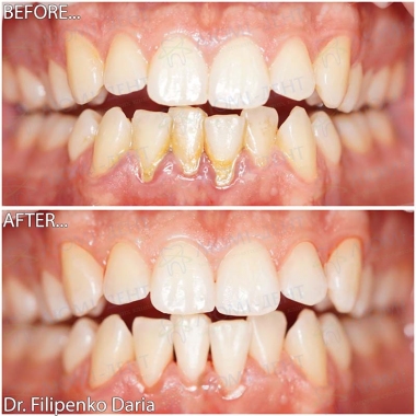 Стоматологія «Люмі-Дент» в Києві
