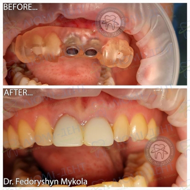 Dentistry «Lumi-Dent» in Kyiv