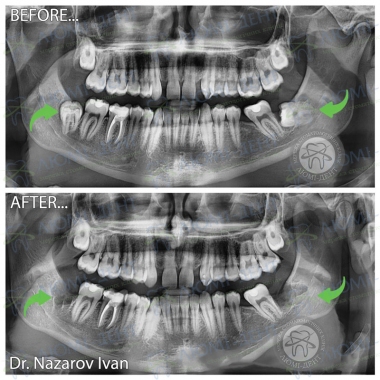 Dentistry «Lumi-Dent» in Kyiv