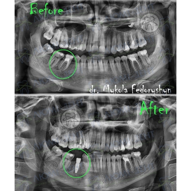 Dentistry Lumi-Dent in Kyiv