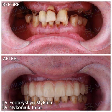Dentistry «Lumi-Dent» in Kyiv