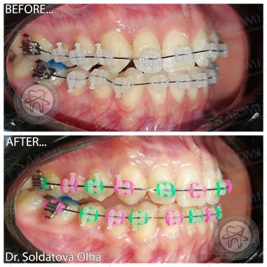 стоматолог-ортодонт Солдатова Ольга