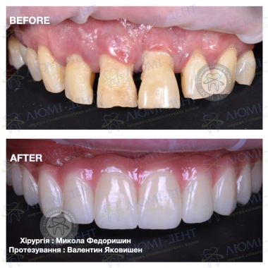 Dentistry «Lumi-Dent» in Kyiv