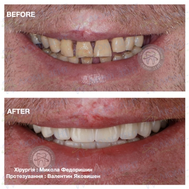 Dentistry «Lumi-Dent» in Kyiv