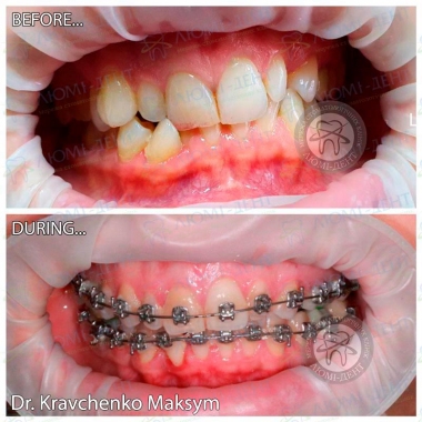 Dentistry «Lumi-Dent» in Kyiv