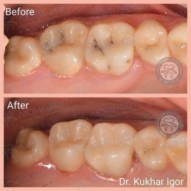 Dentistry «Lumi-Dent» in Kyiv