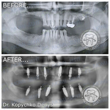 Dentistry Lumi-Dent in Kyiv