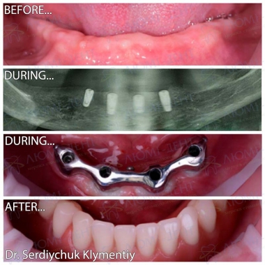 примеры работ хирург Сердийчук Климентий