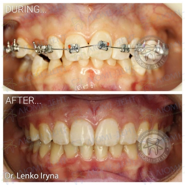 Dentistry «Lumi-Dent» in Kyiv