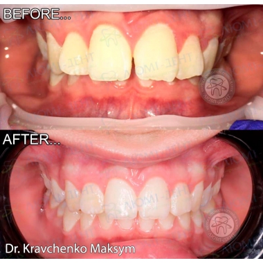 Dentistry «Lumi-Dent» in Kyiv