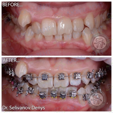 Dentistry «Lumi-Dent» in Kyiv
