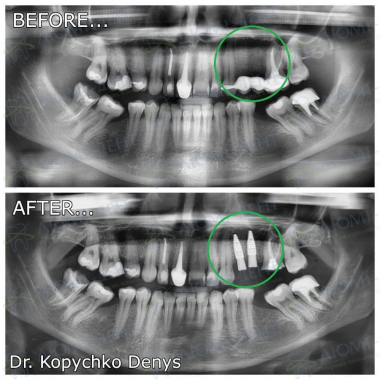 Dentistry Lumi-Dent in Kyiv