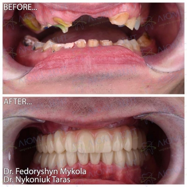 Dentistry «Lumi-Dent» in Kyiv