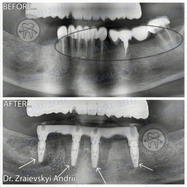 Dentistry Lumi-Dent in Kyiv