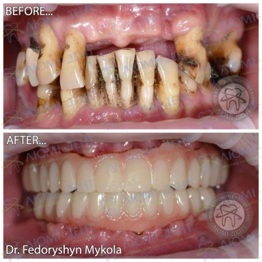 Dentistry «Lumi-Dent» in Kyiv