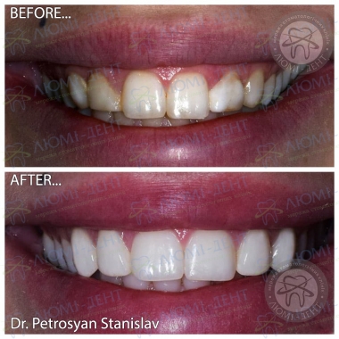 Dentistry Lumi-Dent in Kyiv