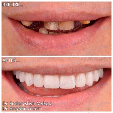Dentistry «Lumi-Dent» in Kyiv