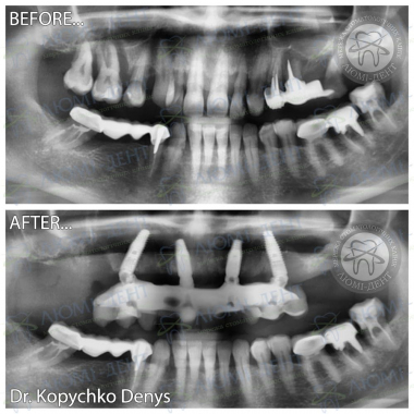 Dentistry Lumi-Dent in Kyiv