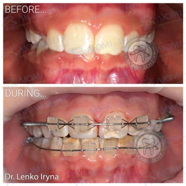 Dentistry «Lumi-Dent» in Kyiv
