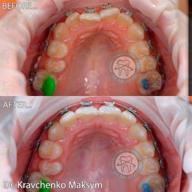 Dentistry «Lumi-Dent» in Kyiv