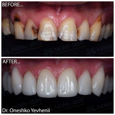 Dentistry «Lumi-Dent» in Kyiv