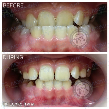 Dentistry «Lumi-Dent» in Kyiv