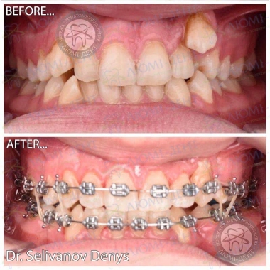 Dentistry «Lumi-Dent» in Kyiv