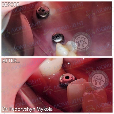 Dentistry «Lumi-Dent» in Kyiv
