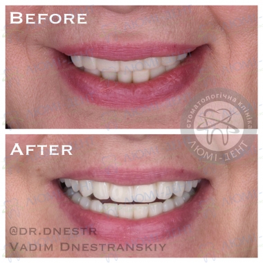 Dentistry Lumi-Dent in Kyiv