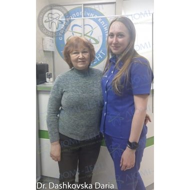 Доктор Дашковская Дарья в работе фото Люми-Дент