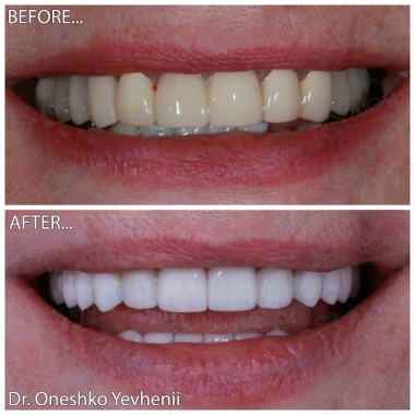 Dentistry «Lumi-Dent» in Kyiv