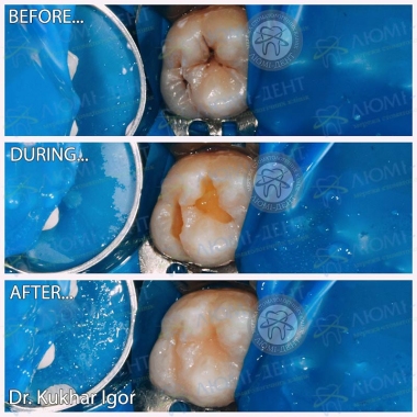 Dentistry «Lumi-Dent» in Kyiv