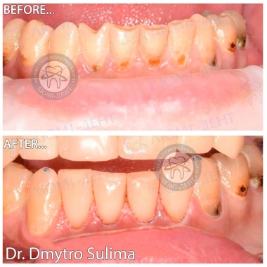 Пример врача стоматолога Сулимы Д.А.