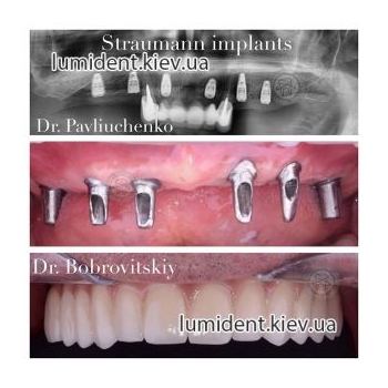 Clinical case 20