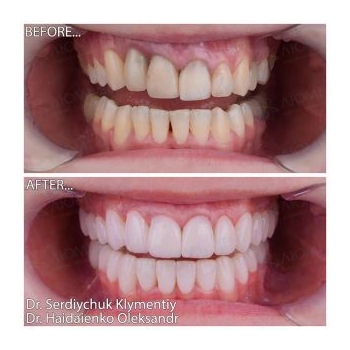 comprehensive dental implantation