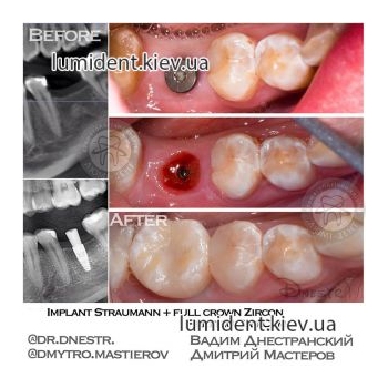 Clinical case 26