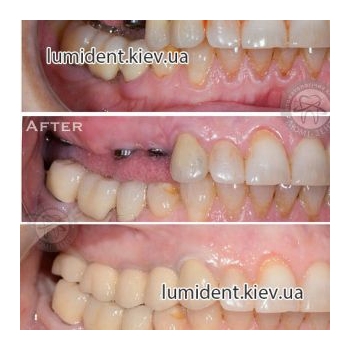 Clinical case 8