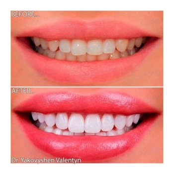Клінічний випадок 71