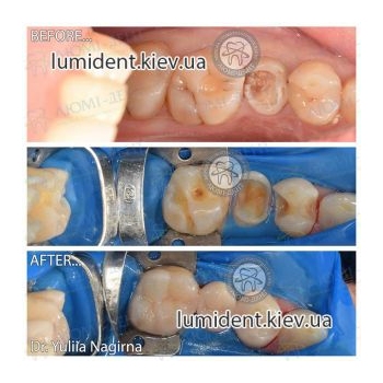 Clinical case 12