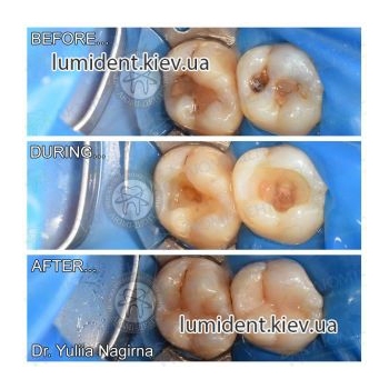 Clinical case 11