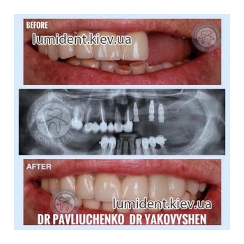 Clinical case 10